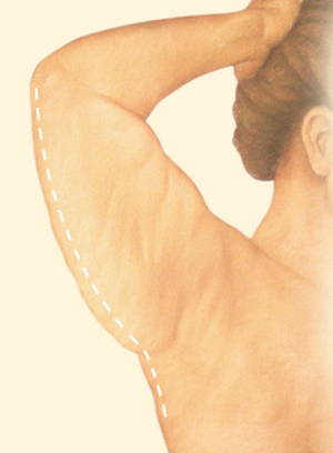 Arm before