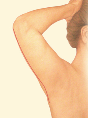 Arm after
