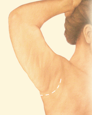 Arm before