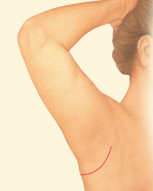 Arm after