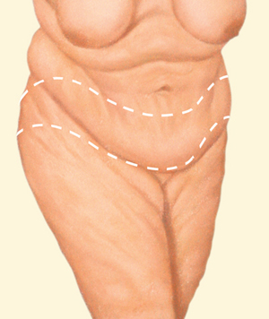 Body before