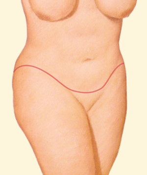 Body after