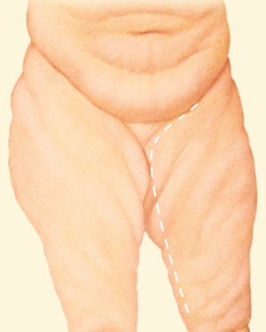 Body before