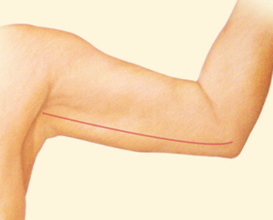 Body after