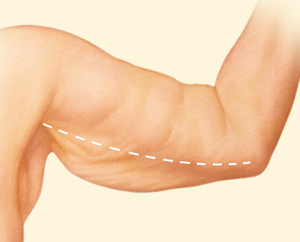 Body before