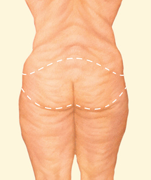 Body before