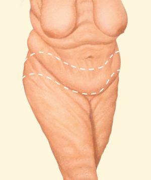 Body before
