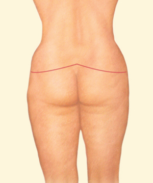 Body after