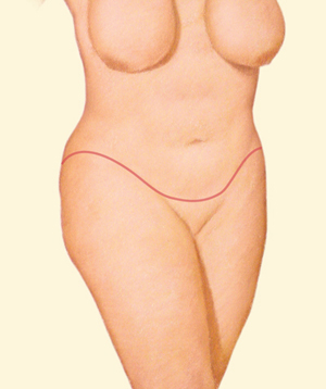 Body after