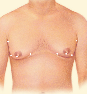 Breast before