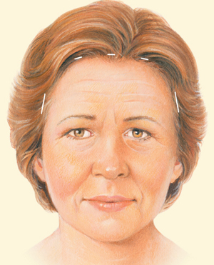 Brow before