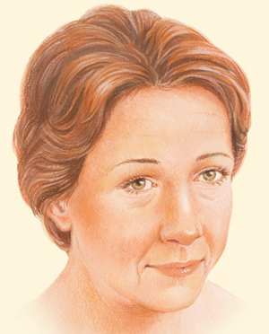 Brow after