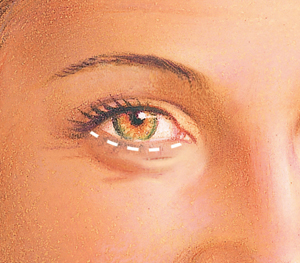Eyes before
