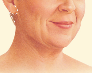 Face before