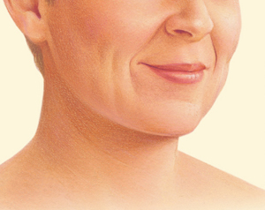 Face after