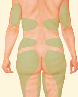 Body before
