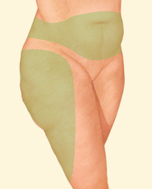 Body before