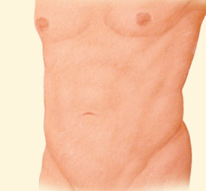 Body after