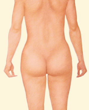 Body after