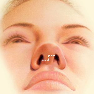 Nose before