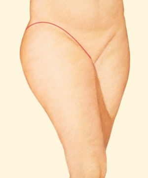 Leg after