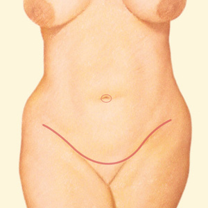 Tummy after