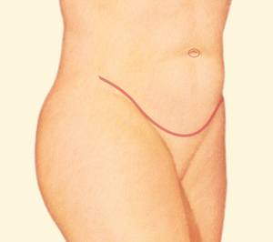 Tummy after