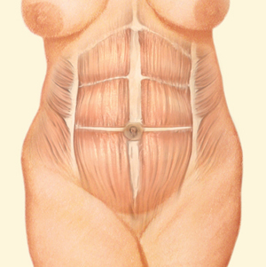 Tummy before