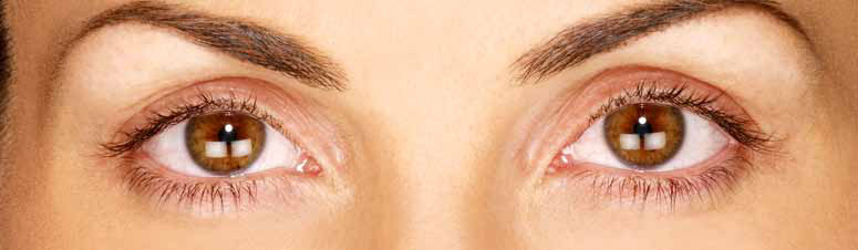Eyelashes before