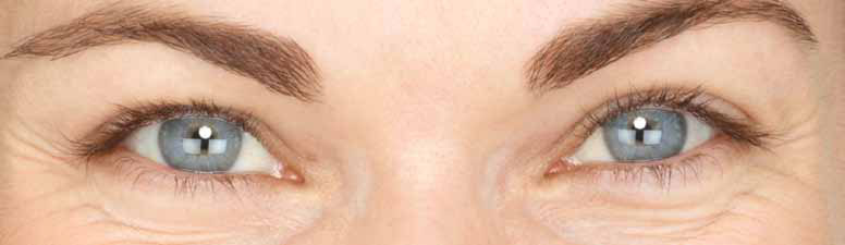 Eyelashes before
