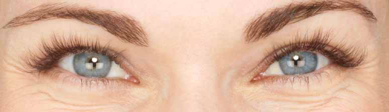 Eyelashes after