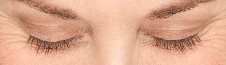 Eyelashes before